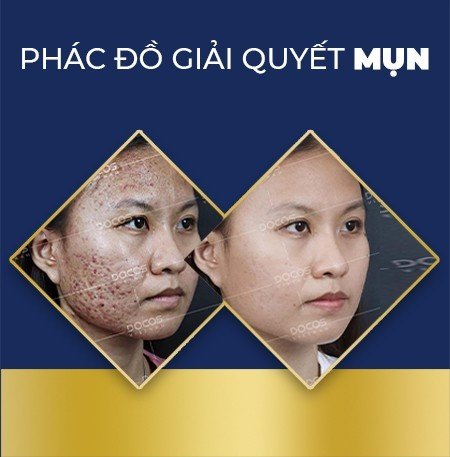 Hình ảnh biểu ngữ