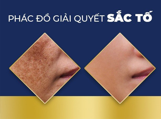 Hình ảnh biểu ngữ