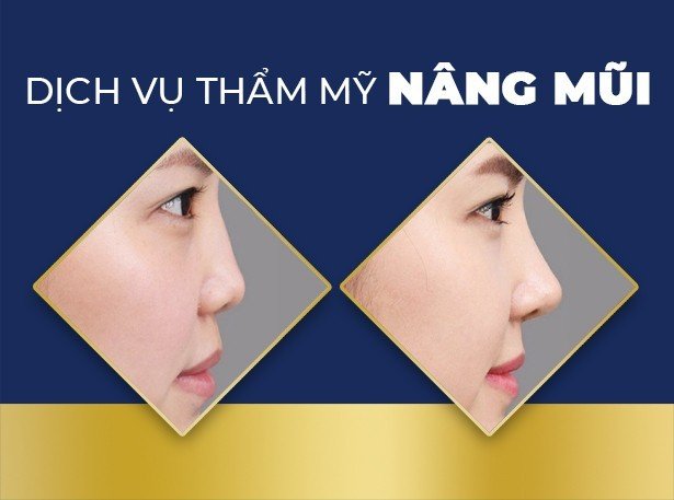 Hình ảnh biểu ngữ